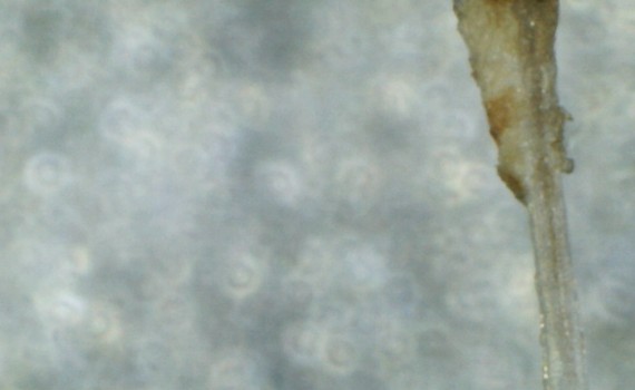 Digital microscope - hair root